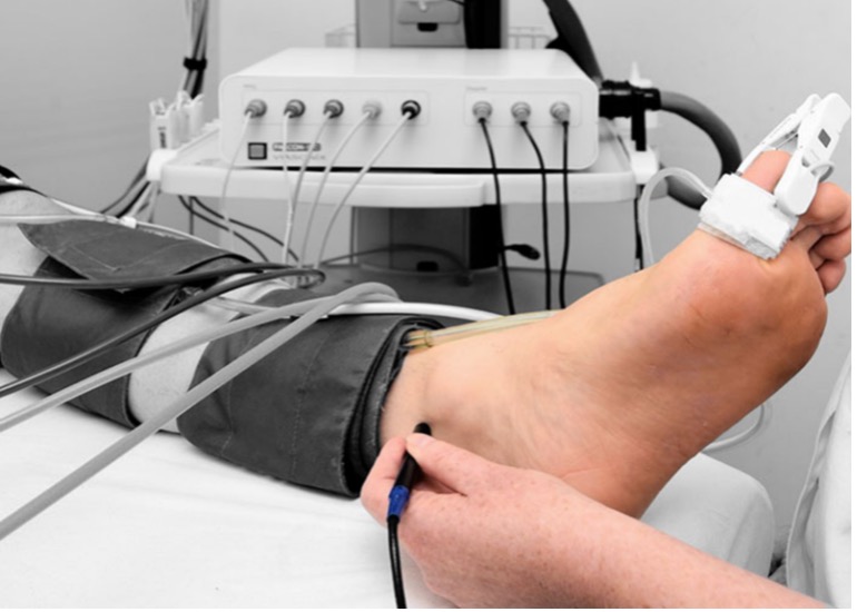 simptomi bolesti krvnih sudova