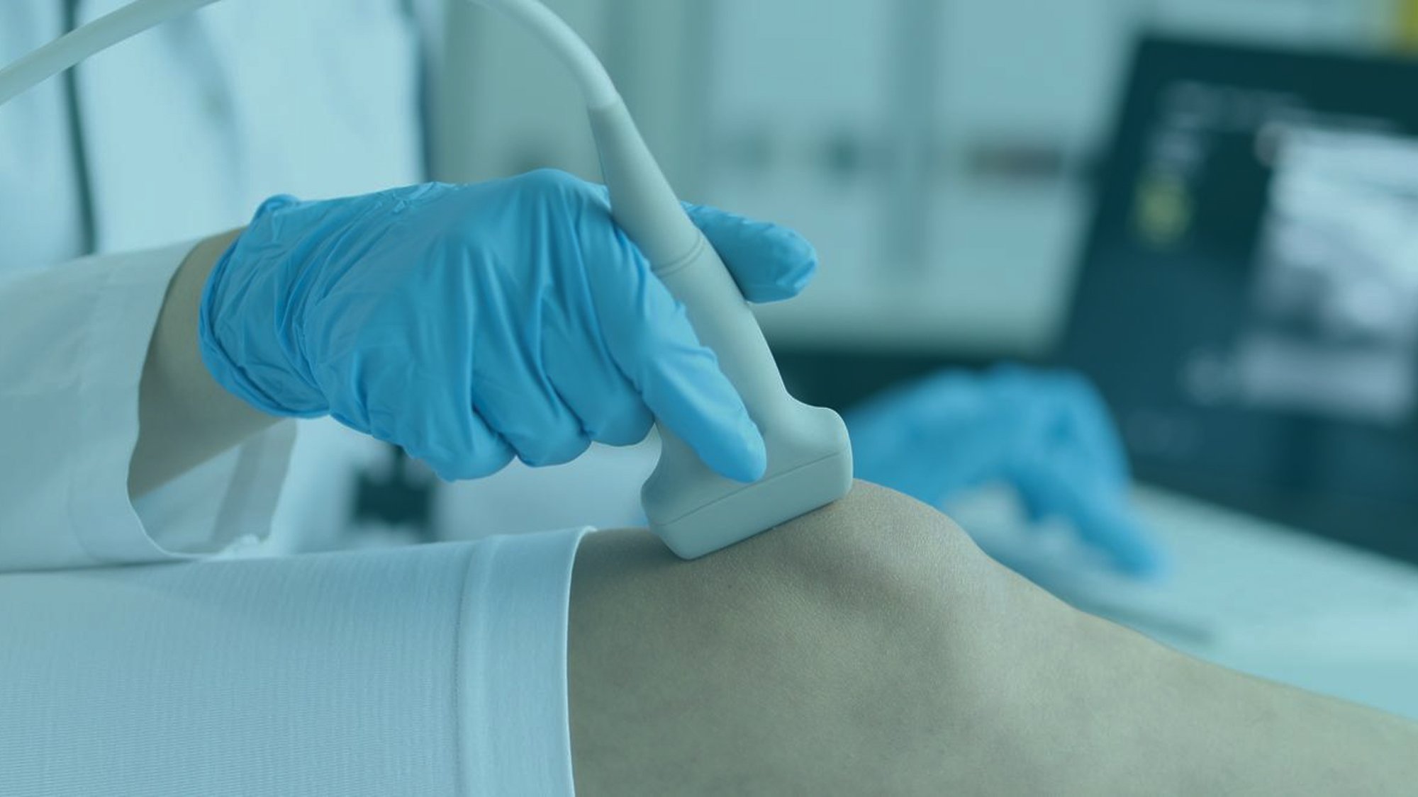 pregled koljena ultrazvukom