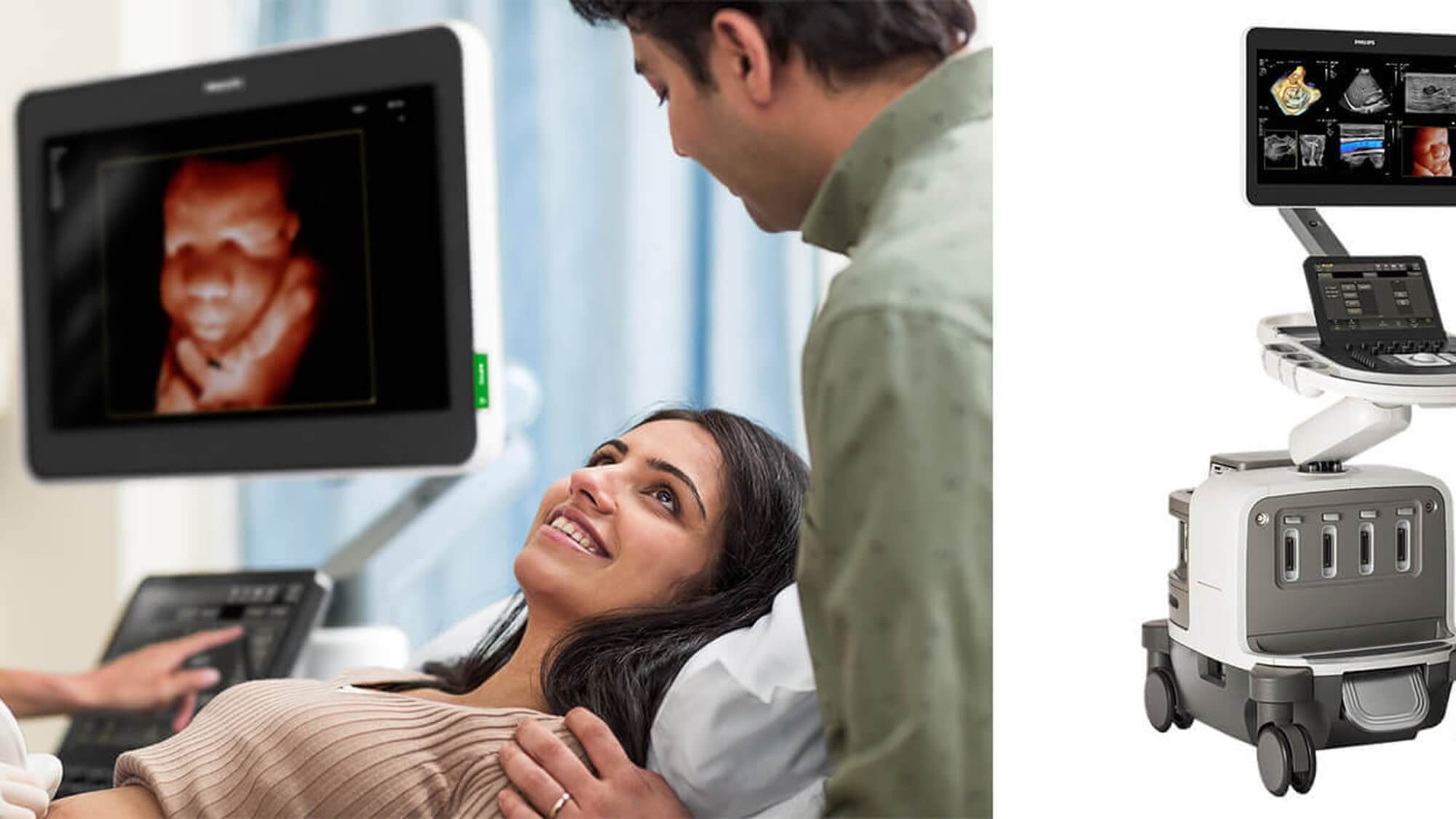 pregled modernim ultrazvučnim aparatom u poliklinici dr. nabil