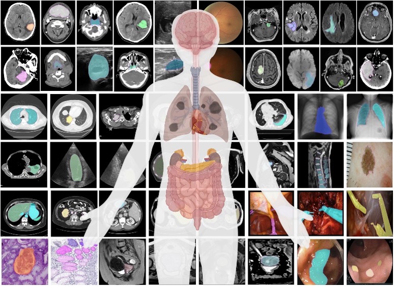 prikaz lujdskog tijela i organa