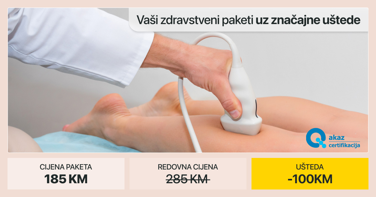 KRVNI SUDOVI DONJIH EKSTREMITETA – Preventivni paket