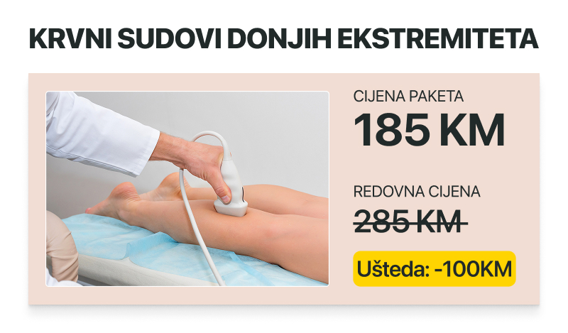 paket krvni sudovi donjih ekstremiteta