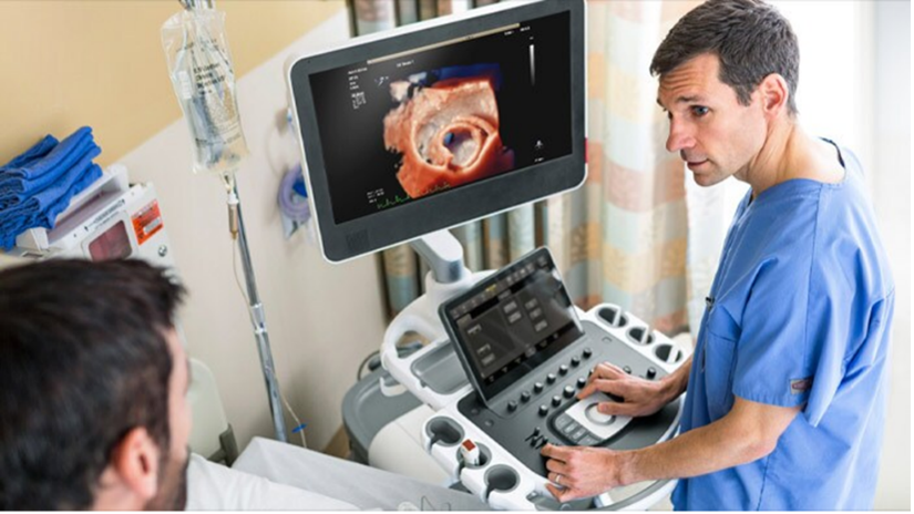 Transezofagealna ehokardiografija (TTE)